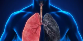 ۵ آسیب پنهان سیگار