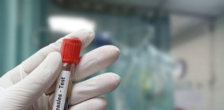 افزایش شدید شیوع سرخک در آمریکای شمالی با ۱۸ مورد فوتی تاکنون