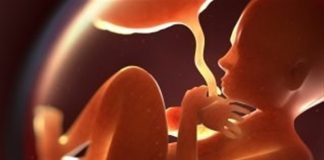 واکنش وزارت بهداشت به شایعات درباره سقط جنین در موارد سندروم داون