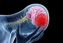 آمار سکته مغزی در ایران و تهران