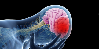 آمار سکته مغزی در ایران و تهران