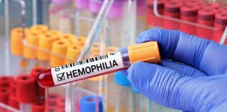 انتقاد از تأمین دارو در کشور؛ کانون هموفیلی خواستار ورود دستگاه قضایی شد