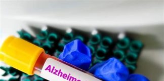 تایید تست خون Elecsys برای ارزیابی اولیه آلزایمر