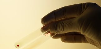 کاهش زمان انتظار پیوند با تغییر گروه خونی کلیه